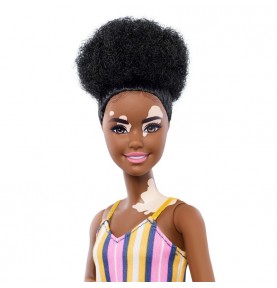 Barbie Fashionista Vitiligo