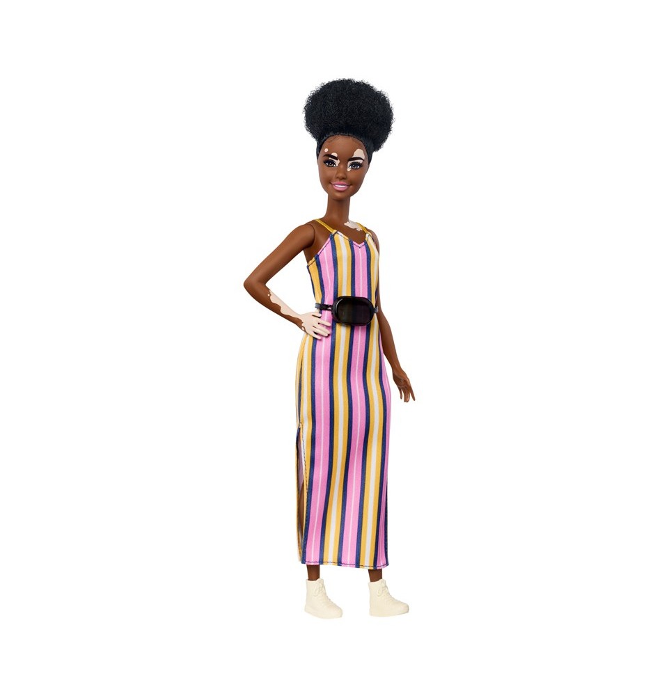 Barbie Fashionista Vitiligo